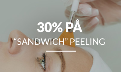 “Sandwich” Peeling 30%