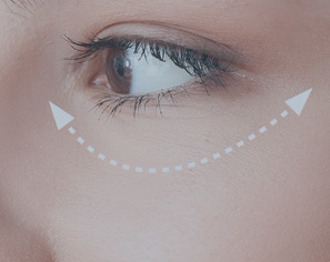 Juvelook® - Polymælkesyre til øjenregionen