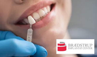 Samarbejde med Brædstrup