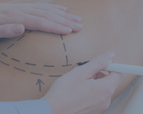 Plastikkirurgi (rekonstruktiv)