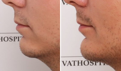 Case - marts 22 - hage