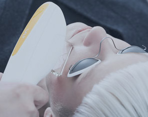 IPL (Nordlys) laser Rejuvenation