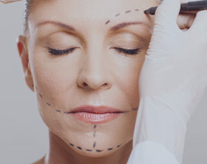 Kirgurisk ansigtsløft