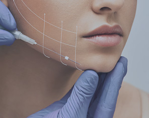 Trådløft & Trådarmering